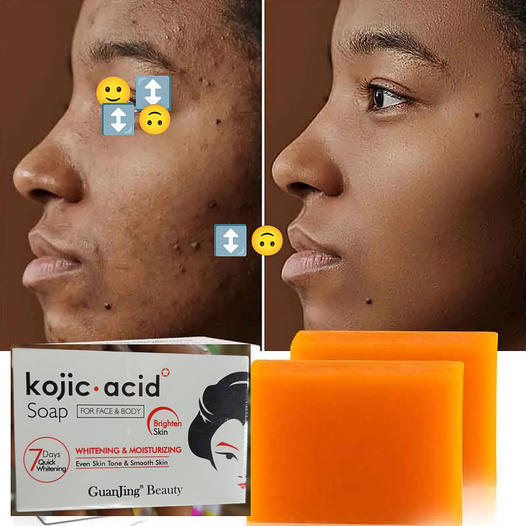 Savons Kojic –Purifie, Nettoie et Illumine Visiblement la Peau