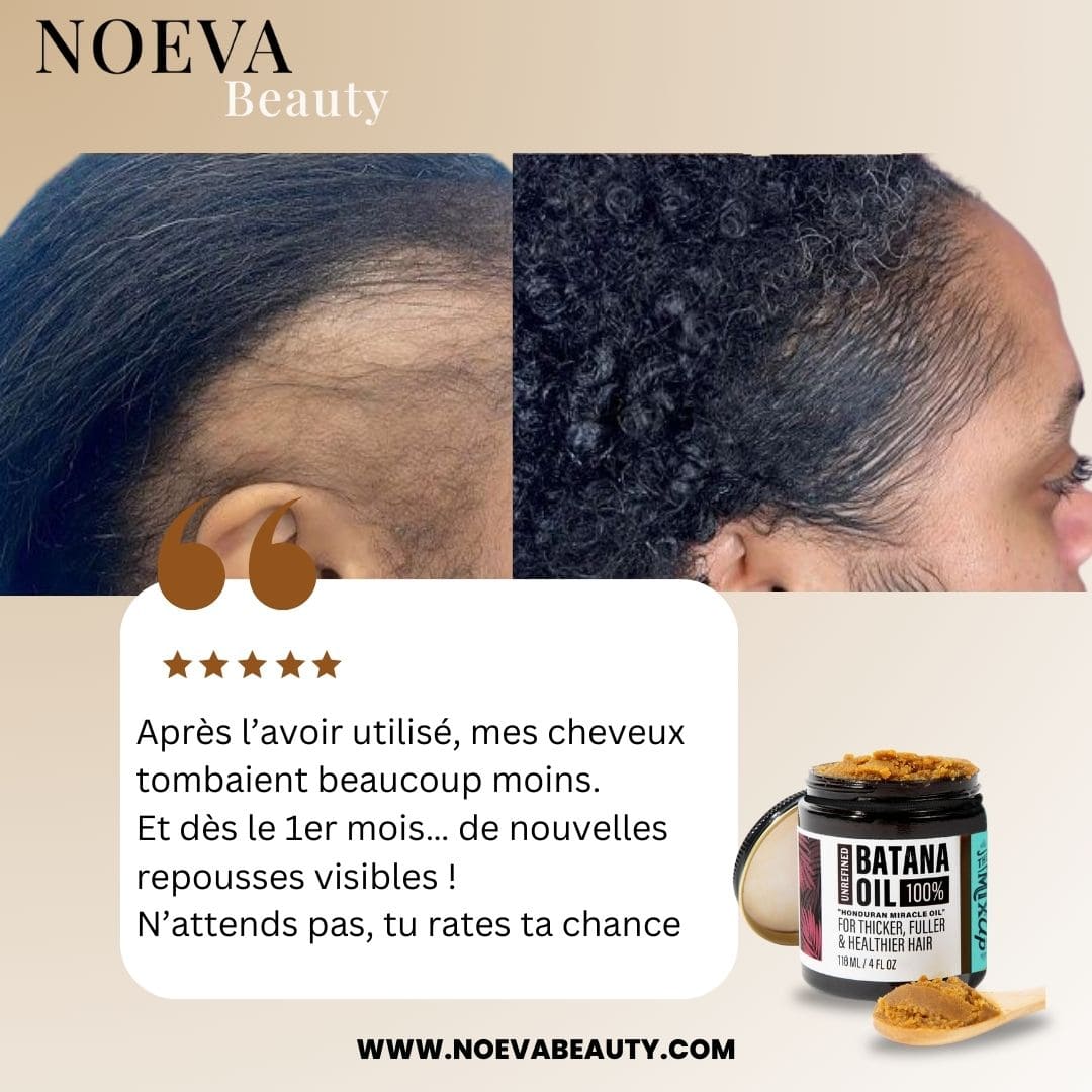 NOEVA - 100% Pur Batana