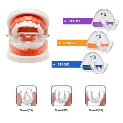 Appareil orthodontique en 3 étapes